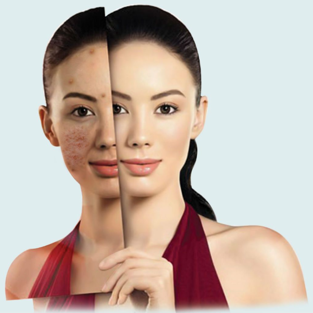 Scar Removal